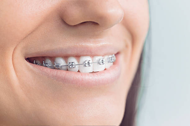 Best Dental Fillings (Composite and Amalgam)  in Oak Trail Shores, TX